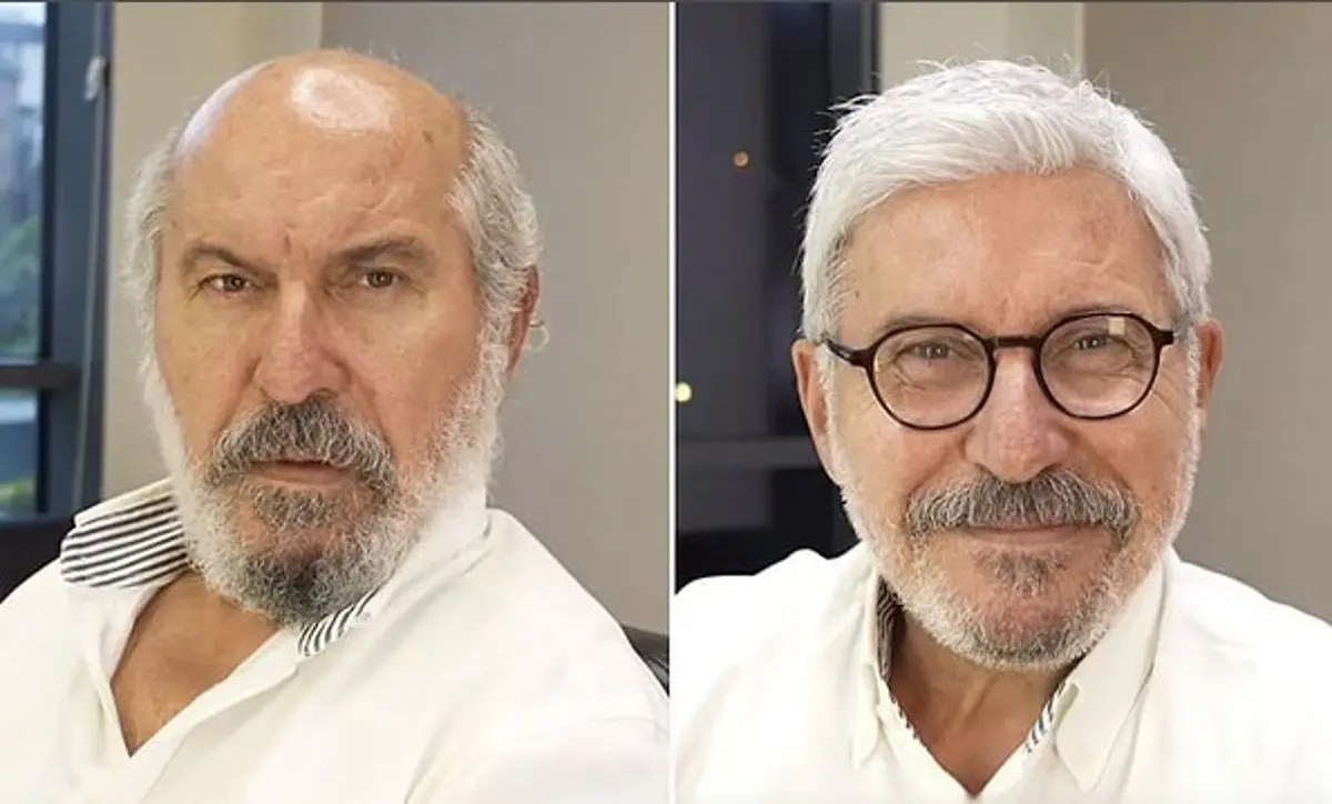 Usta Oyuncu Hüseyin Soysalan İmaj Tazeledi: Protez Saçlı Yeni Hali Görenleri Şaşkına Çevirdi